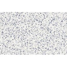 Frammento Macro Azzurro R10 Rt 60х120