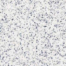 Frammento Macro Azzurro R10 Rt